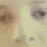 Anthony